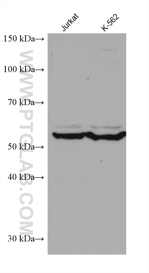 Western Blot (WB) analysis of various lysates using CCT6B Monoclonal antibody (67961-1-Ig)