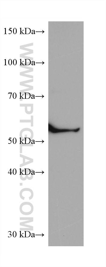 Western Blot (WB) analysis of NIH/3T3 cells using CCT6B Monoclonal antibody (67961-1-Ig)