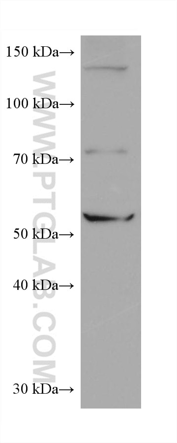 Western Blot (WB) analysis of HSC-T6 cells using CCT6B Monoclonal antibody (67961-1-Ig)