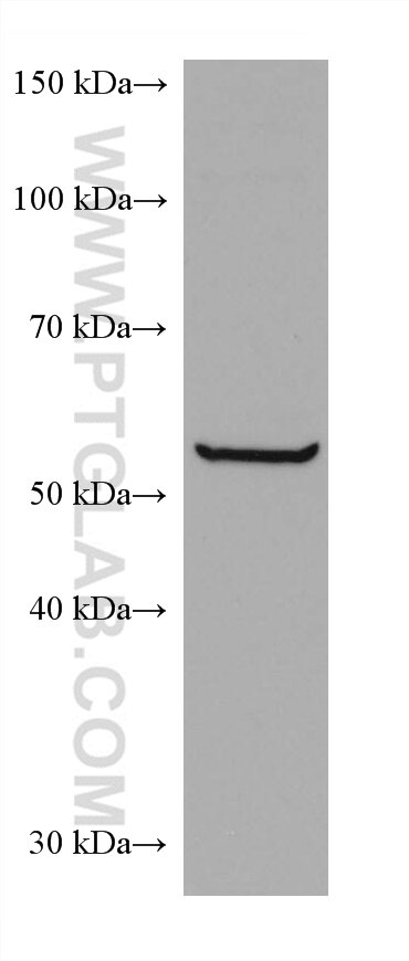 Western Blot (WB) analysis of HEK-293 cells using CCT6B Monoclonal antibody (67961-1-Ig)