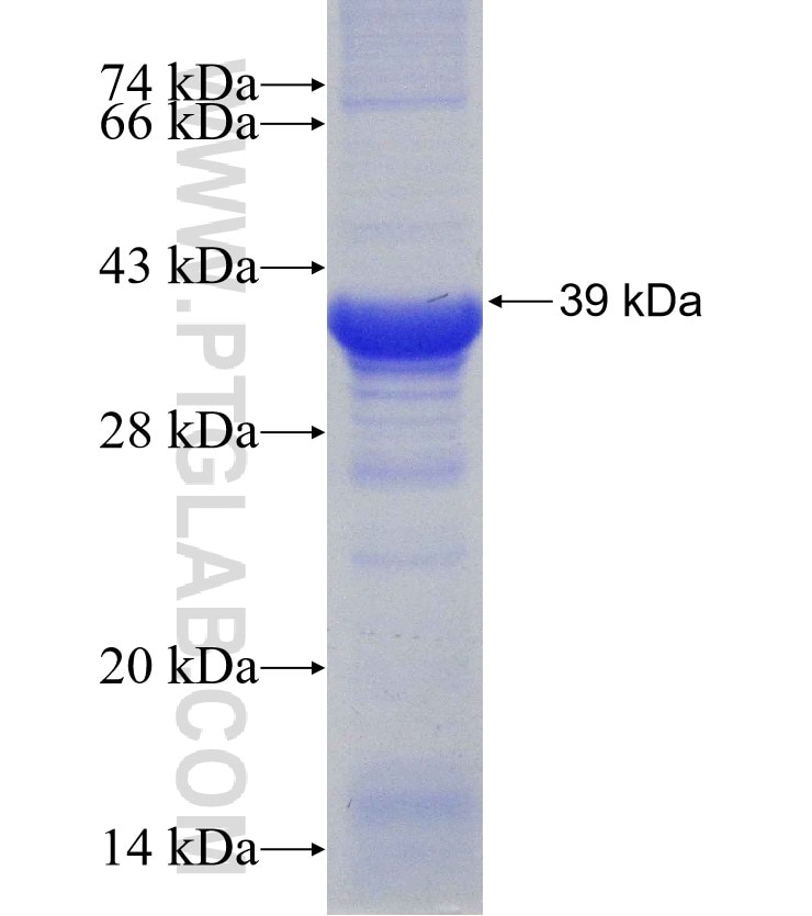 CCT6B fusion protein Ag31295 SDS-PAGE