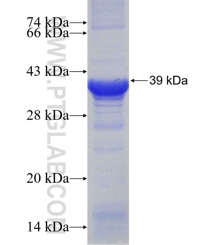 CCT6B fusion protein Ag31295 SDS-PAGE
