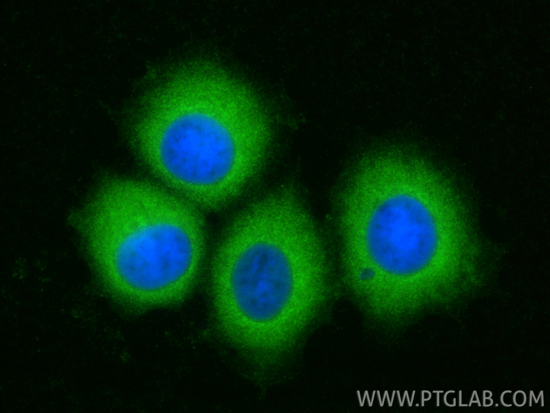 Immunofluorescence (IF) / fluorescent staining of MCF-7 cells using TCP1 eta Polyclonal antibody (15994-1-AP)