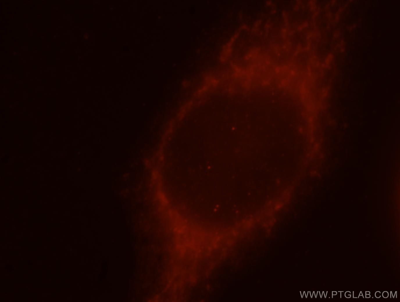 Immunofluorescence (IF) / fluorescent staining of MCF-7 cells using CCT7 Polyclonal antibody (15994-1-AP)