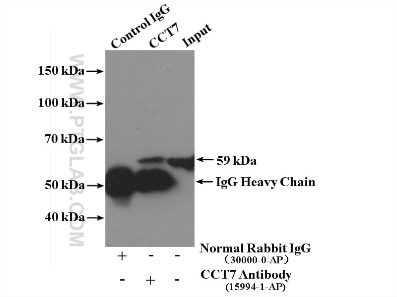 Immunoprecipitation (IP) experiment of HEK-293 cells using CCT7 Polyclonal antibody (15994-1-AP)