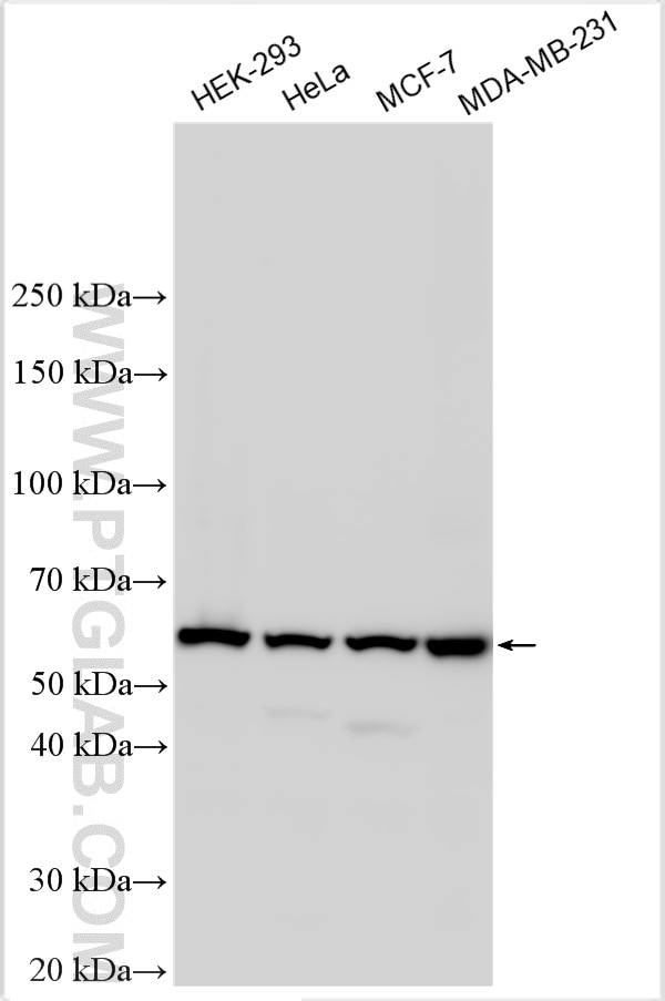 Western Blot (WB) analysis of various lysates using TCP1 eta Polyclonal antibody (15994-1-AP)