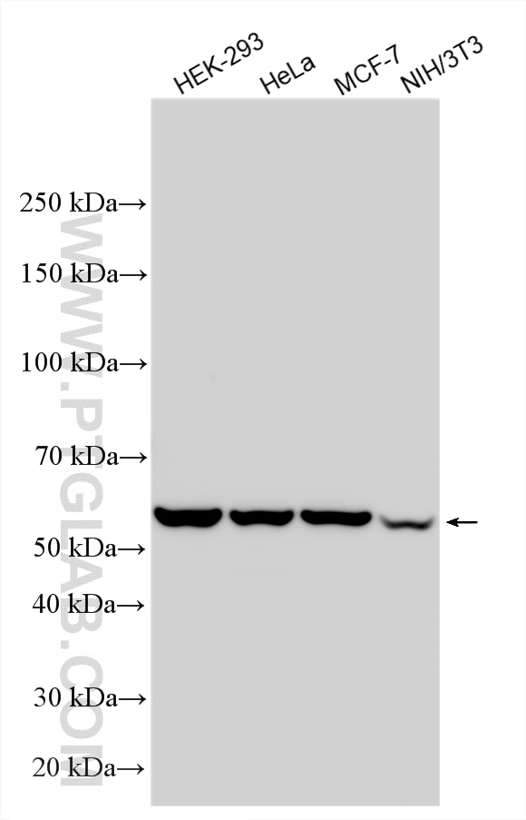 WB analysis using 15994-1-AP Western Blot (WB) analysis of various lysates using TCP1 eta Polyclonal antibody (15994-1-AP)