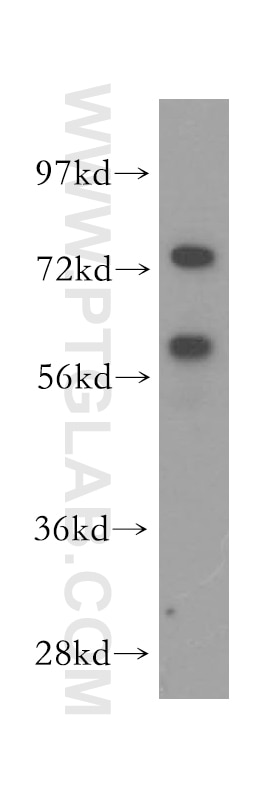 Western Blot (WB) analysis of human brain tissue using CCT7 Polyclonal antibody (15994-1-AP)