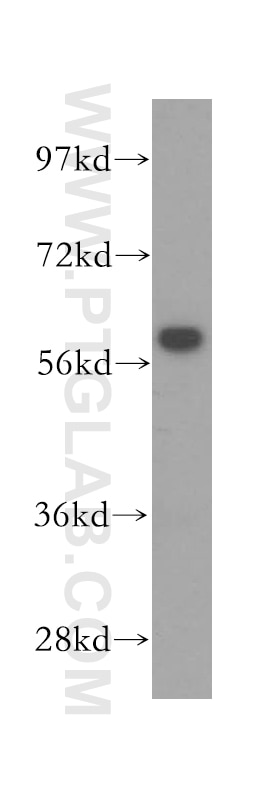 Western Blot (WB) analysis of HeLa cells using CCT7 Polyclonal antibody (15994-1-AP)