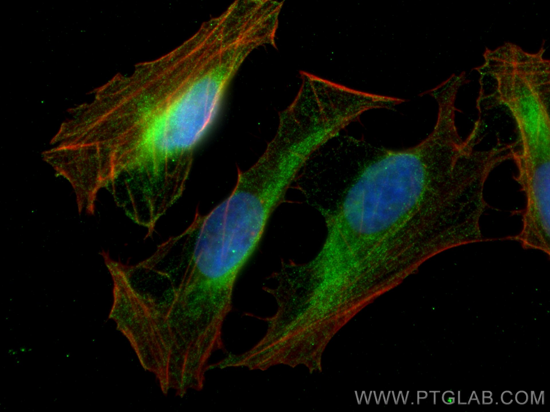 Immunofluorescence (IF) / fluorescent staining of U2OS cells using CCT7 Monoclonal antibody (67540-1-Ig)