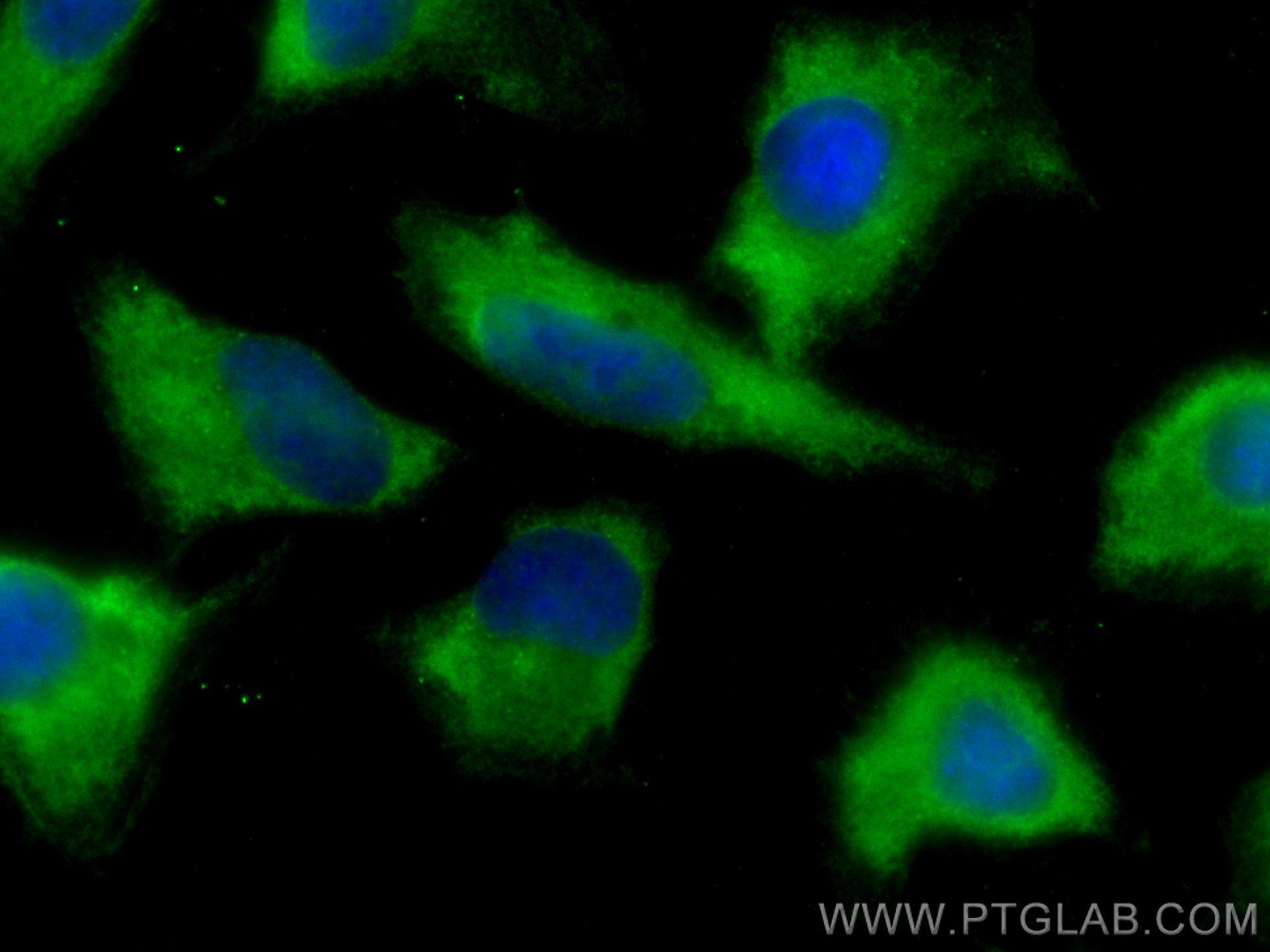 Immunofluorescence (IF) / fluorescent staining of U2OS cells using CCT7 Monoclonal antibody (67540-1-Ig)