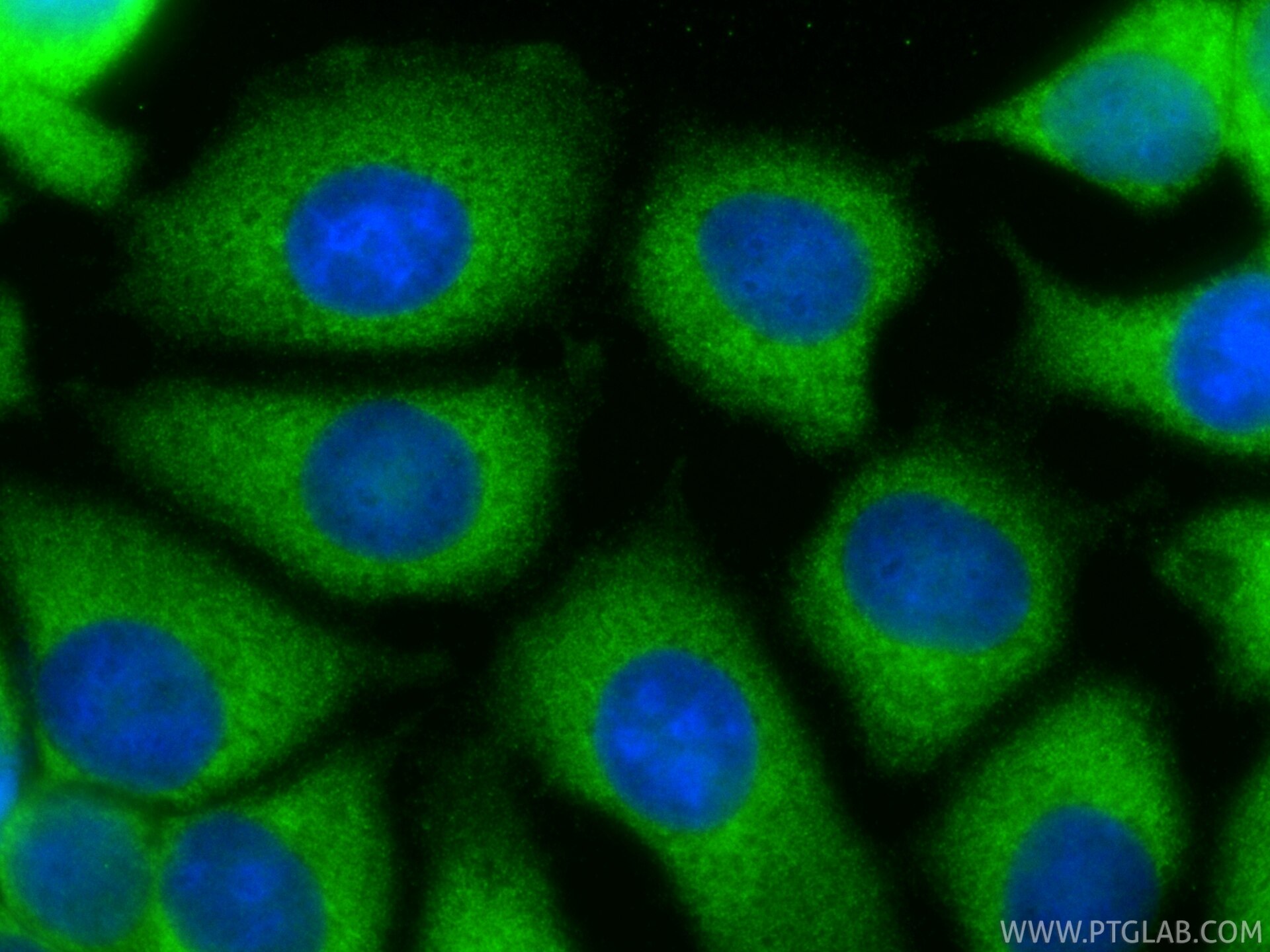 IF Staining of MCF-7 using 67540-1-Ig Immunofluorescence (IF) / fluorescent staining of MCF-7 cells using TCP1 eta Monoclonal antibody (67540-1-Ig)