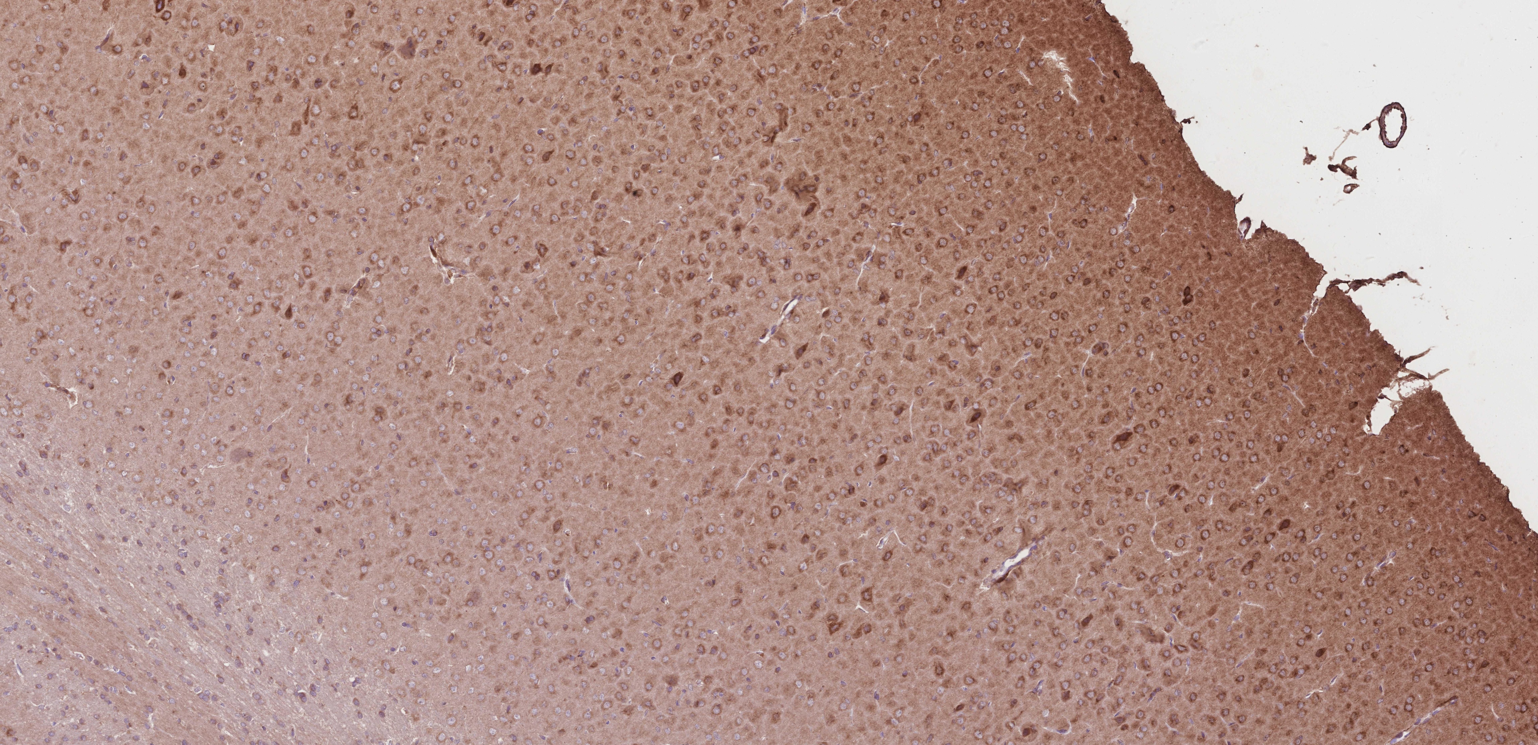 Immunohistochemistry (IHC) staining of rat brain tissue using TCP1 eta Monoclonal antibody (67540-1-Ig)
