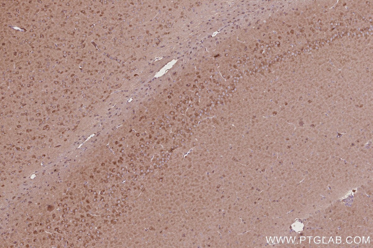 Immunohistochemistry (IHC) staining of rat brain tissue using TCP1 eta Monoclonal antibody (67540-1-Ig)