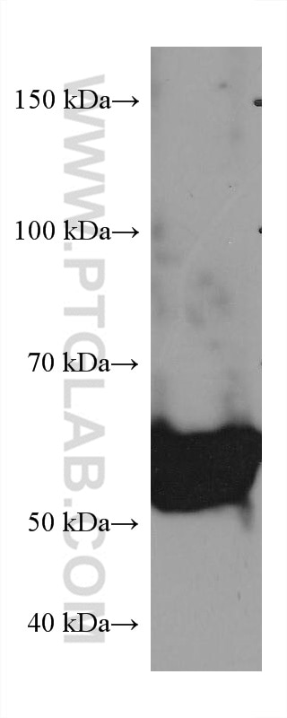 Western Blot (WB) analysis of NIH/3T3 cells using CCT7 Monoclonal antibody (67540-1-Ig)