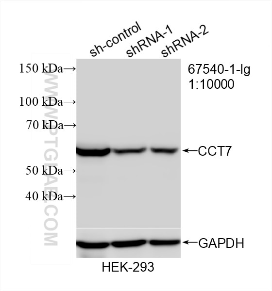 Western Blot (WB) analysis of HEK-293 cells using CCT7 Monoclonal antibody (67540-1-Ig)
