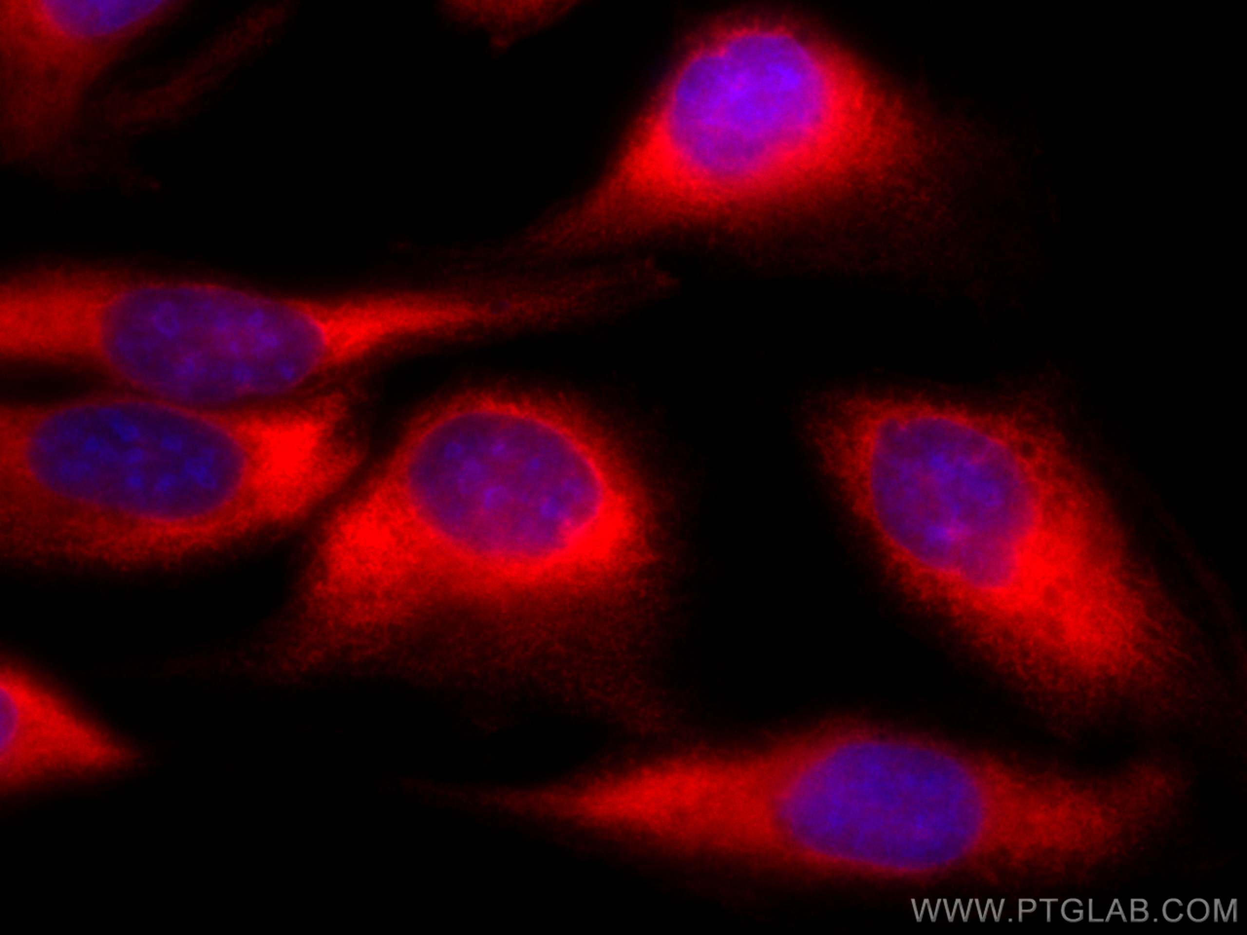 Immunofluorescence (IF) / fluorescent staining of U2OS cells using CoraLite®594-conjugated CCT7 Monoclonal antibody (CL594-67540)