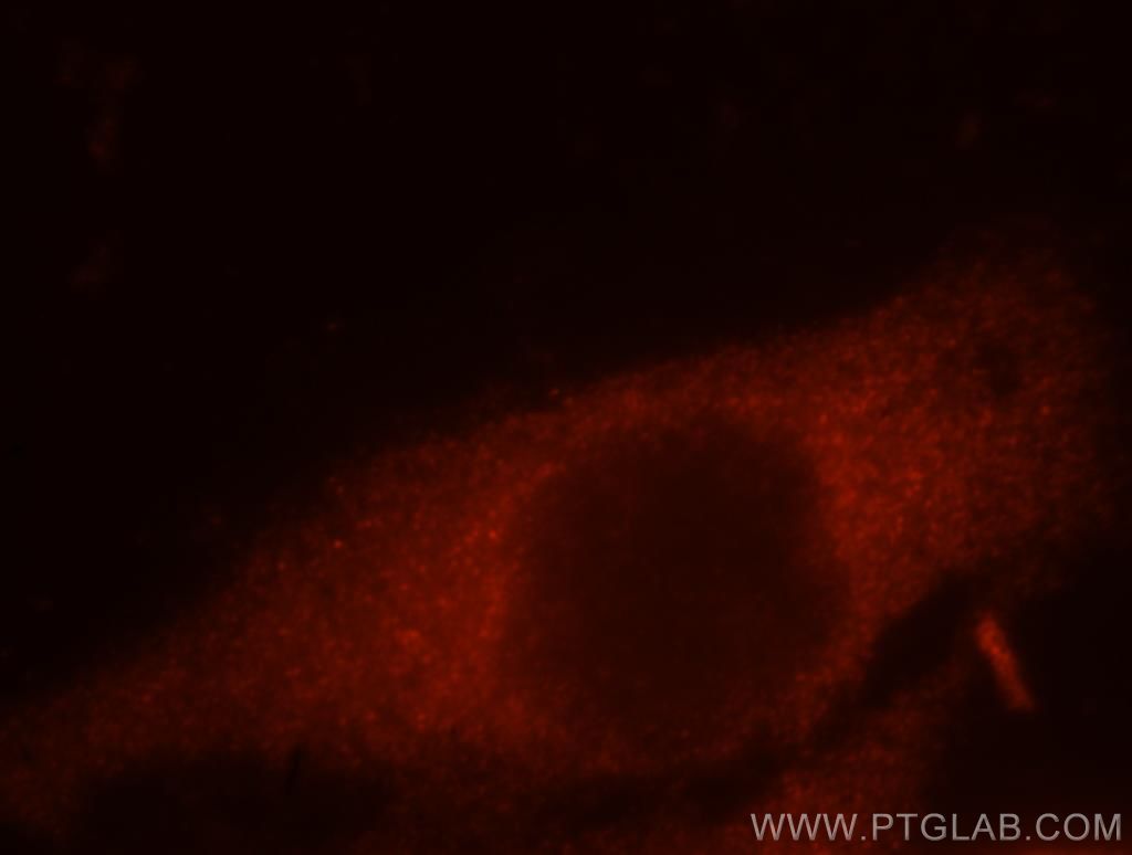 Immunofluorescence (IF) / fluorescent staining of MCF-7 cells using CCT8 Polyclonal antibody (12263-1-AP)