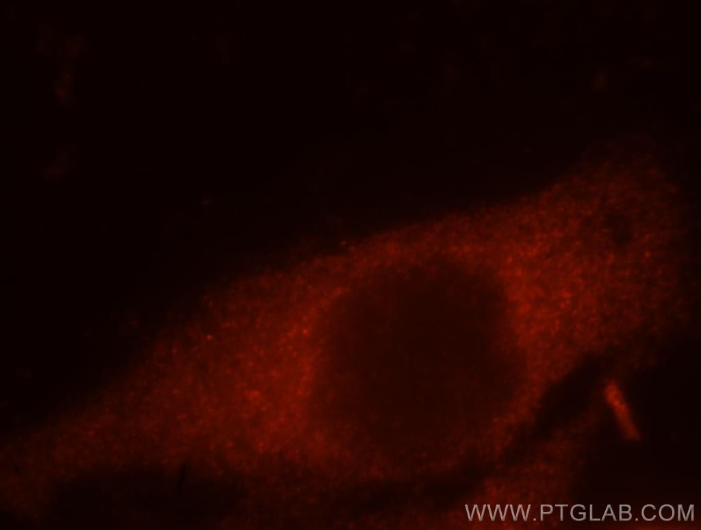 IF Staining of MCF-7 using 12263-1-AP