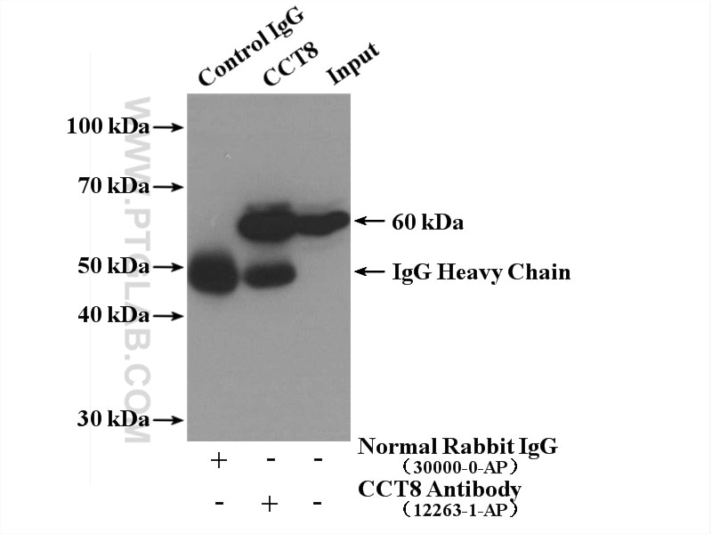 Immunoprecipitation (IP) experiment of Jurkat cells using CCT8 Polyclonal antibody (12263-1-AP)