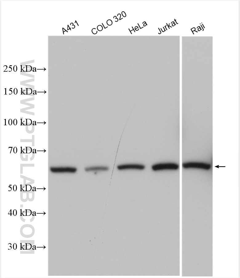 Western Blot (WB) analysis of various lysates using CCT8 Polyclonal antibody (12263-1-AP)