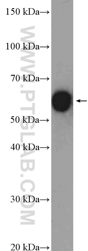 Western Blot (WB) analysis of mouse kidney tissue using CCT8 Polyclonal antibody (12263-1-AP)