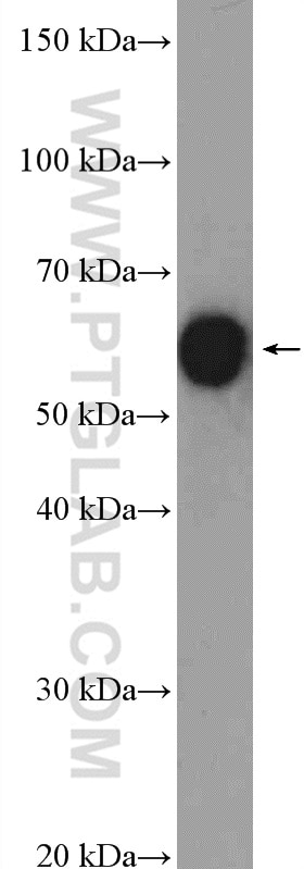 WB analysis of mouse kidney using 12263-1-AP