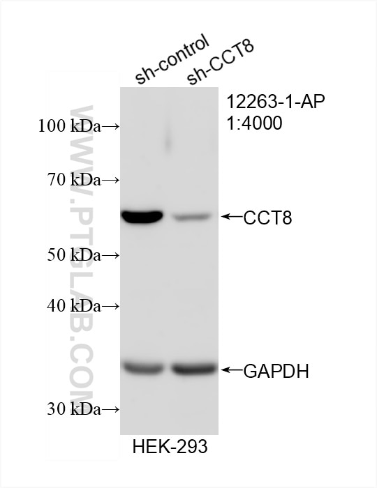Western Blot (WB) analysis of HEK-293 cells using CCT8 Polyclonal antibody (12263-1-AP)