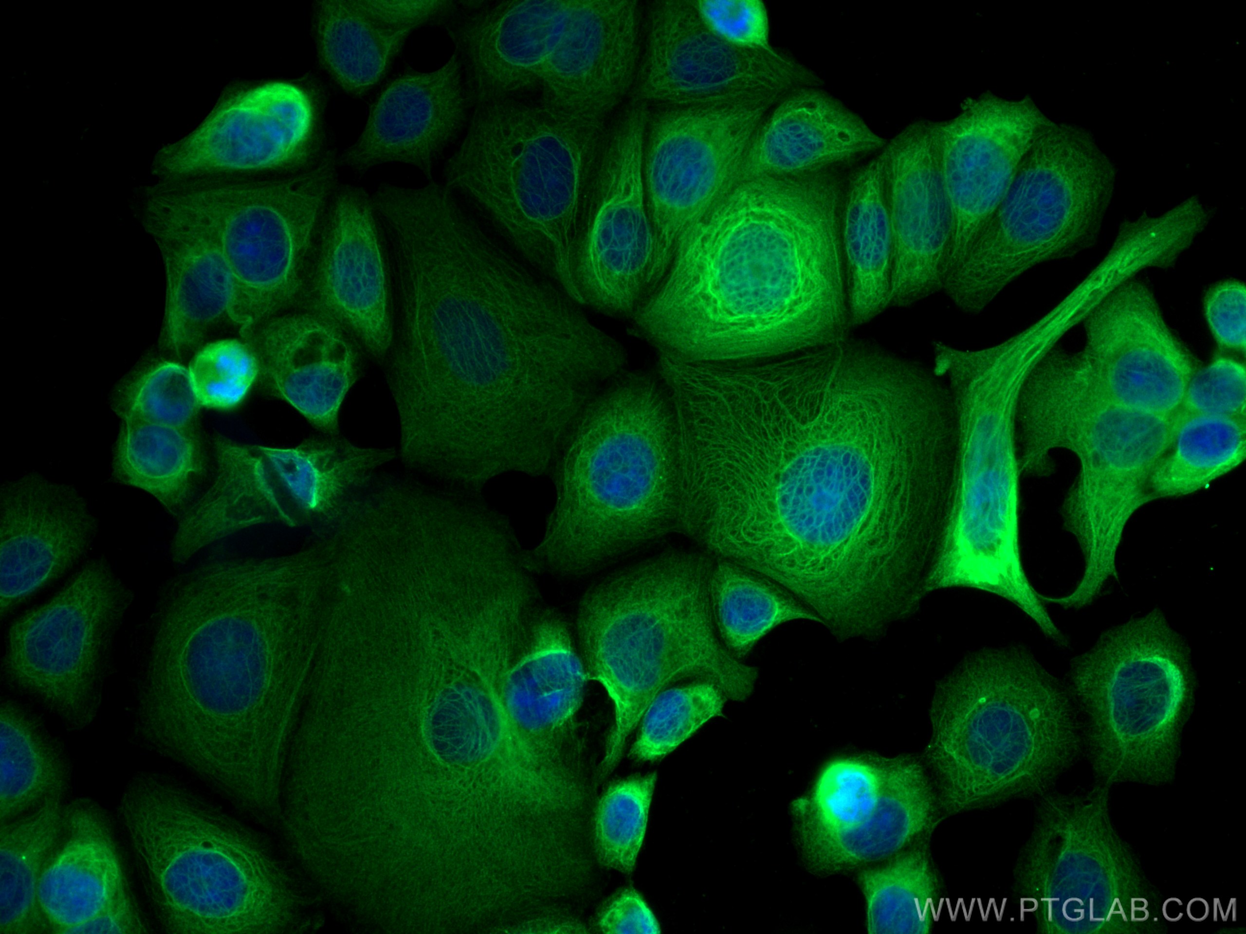Immunofluorescence (IF) / fluorescent staining of MCF-7 cells using CCT8 Monoclonal antibody (67539-1-Ig)