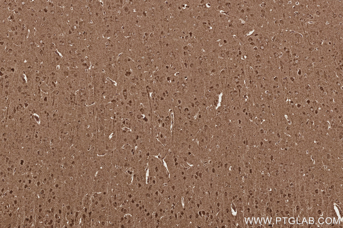 IHC staining of rat brain using 67539-1-Ig Immunohistochemistry (IHC) staining of rat brain tissue using CCT8 Monoclonal antibody (67539-1-Ig)