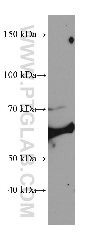 Western Blot (WB) analysis of NIH/3T3 cells using CCT8 Monoclonal antibody (67539-1-Ig)