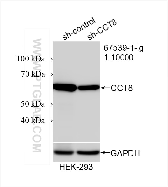 Western Blot (WB) analysis of HEK-293 cells using CCT8 Monoclonal antibody (67539-1-Ig)