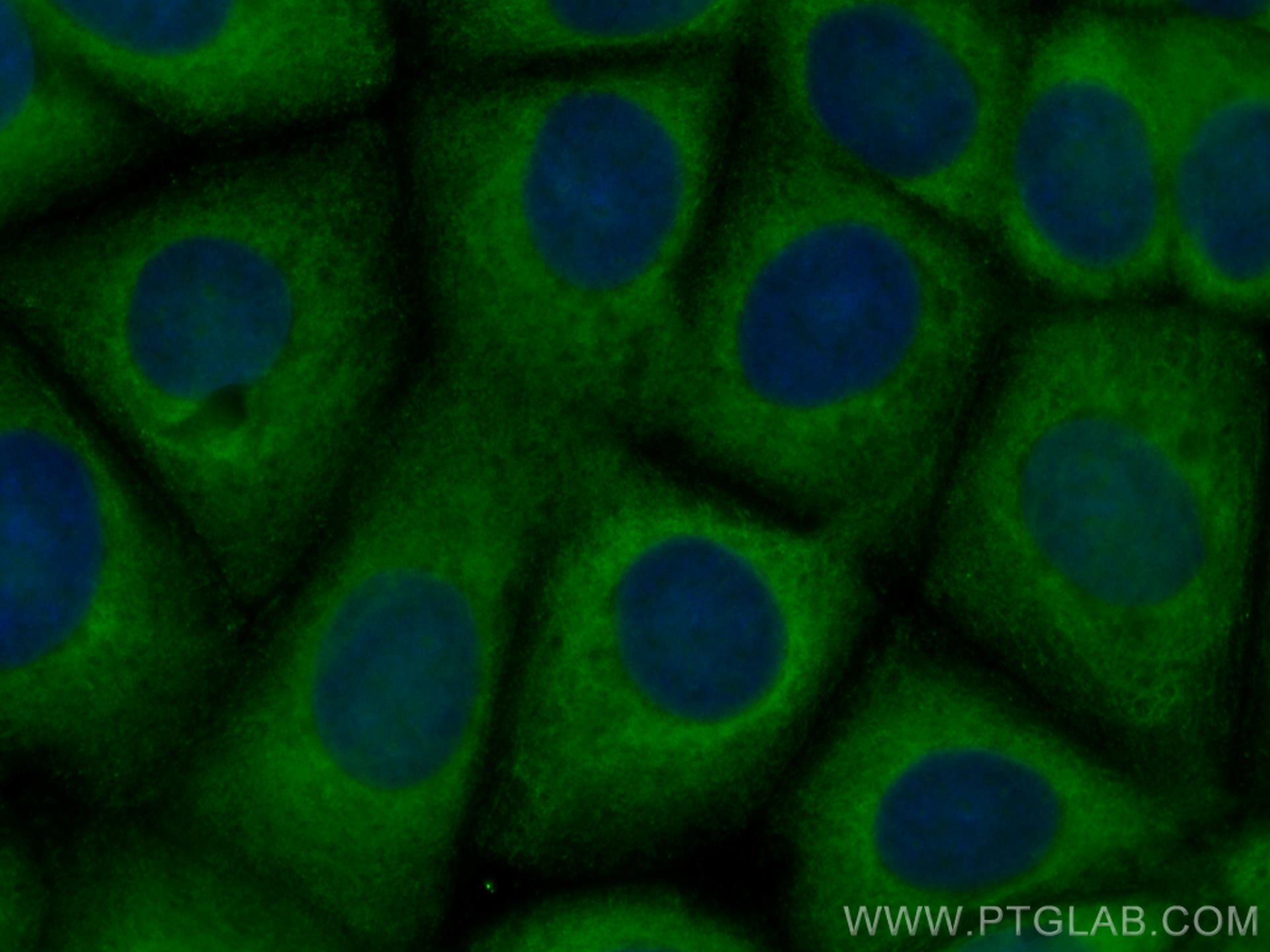 Immunofluorescence (IF) / fluorescent staining of MCF-7 cells using CoraLite® Plus 488-conjugated CCT8 Monoclonal anti (CL488-67539)