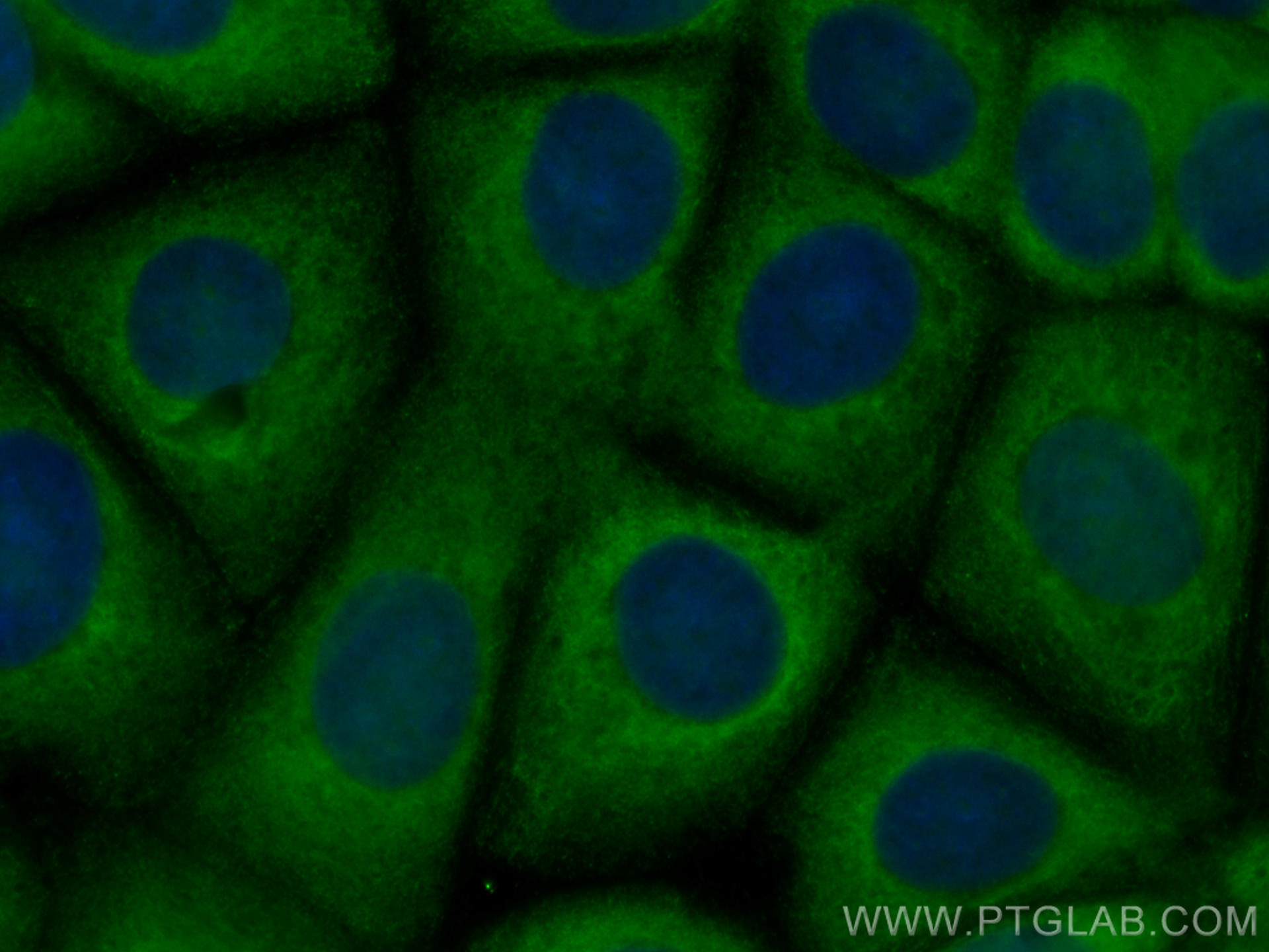 IF Staining of MCF-7 using CL488-67539