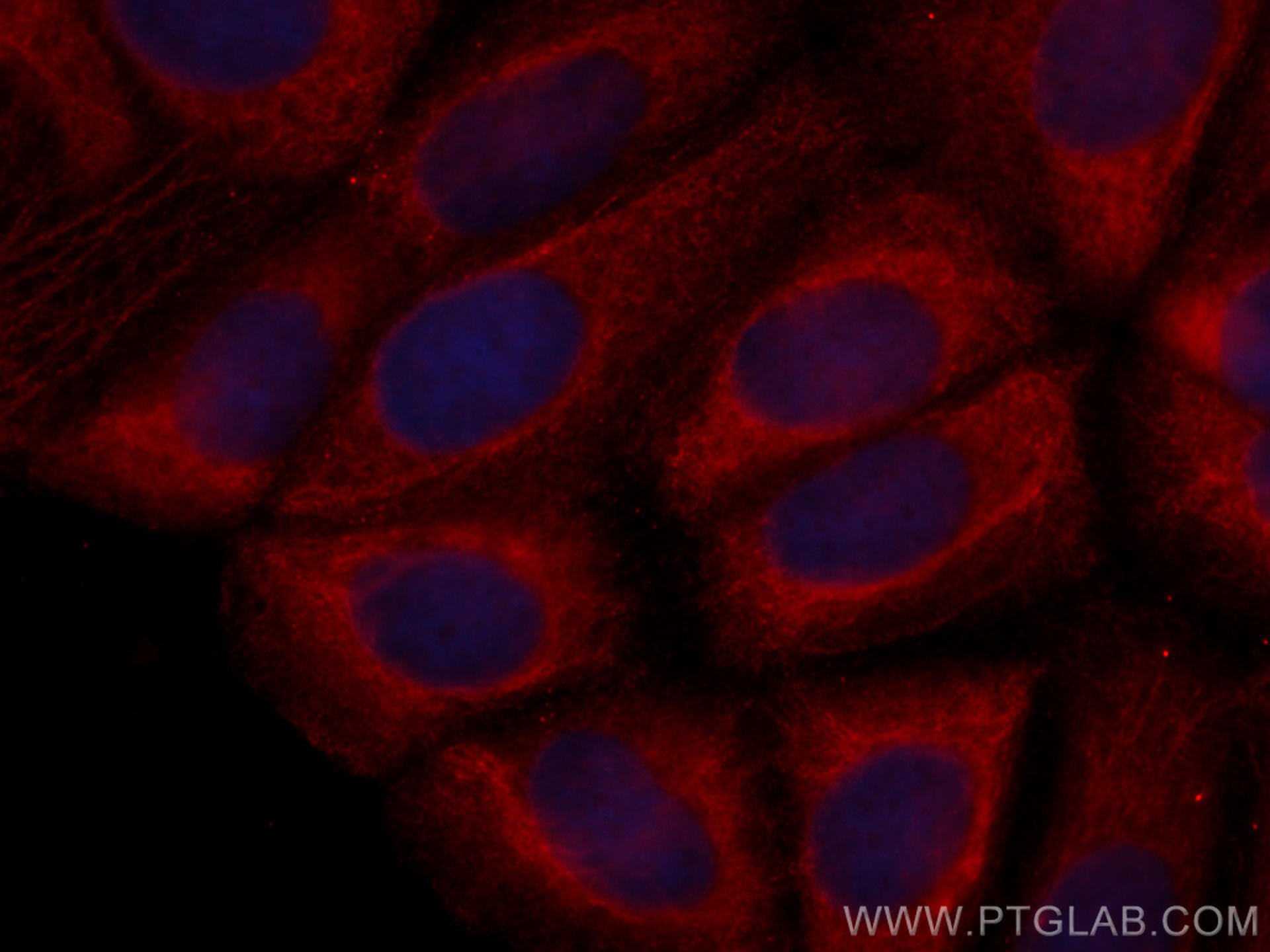 Immunofluorescence (IF) / fluorescent staining of MCF-7 cells using CoraLite®594-conjugated CCT8 Monoclonal antibody (CL594-67539)