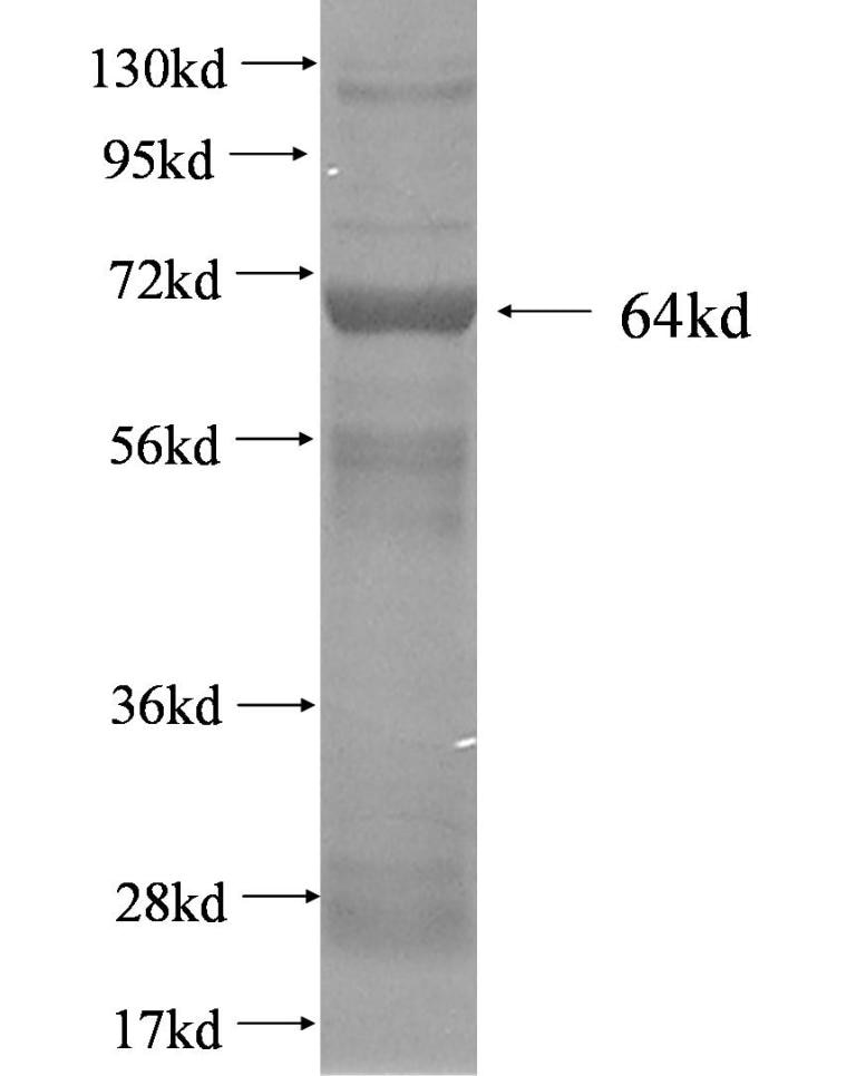 CCT8 fusion protein Ag2926 SDS-PAGE