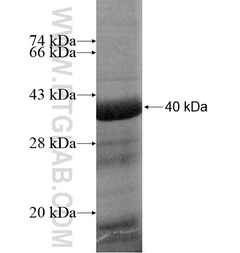 CCT8L2 fusion protein Ag15512 SDS-PAGE
