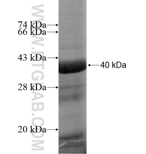 CCT8L2 fusion protein Ag15512 SDS-PAGE CCT8L2 fusion protein Ag15512 SDS-PAGE
