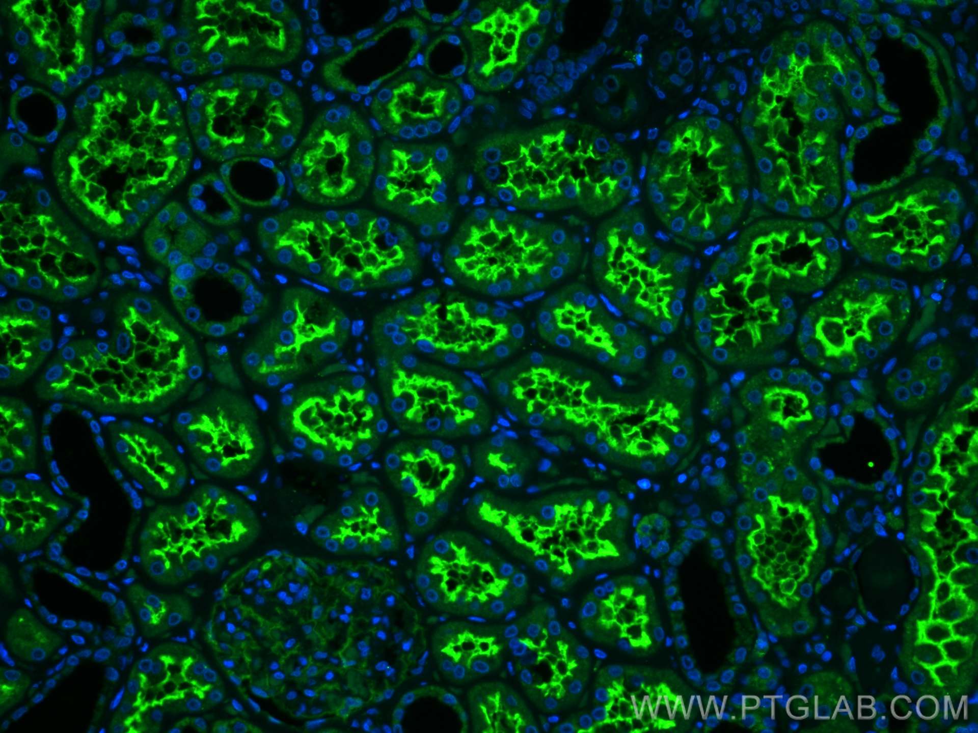 Immunofluorescence (IF) / fluorescent staining of human kidney tissue using MME,CD10 Polyclonal antibody (23782-1-AP)