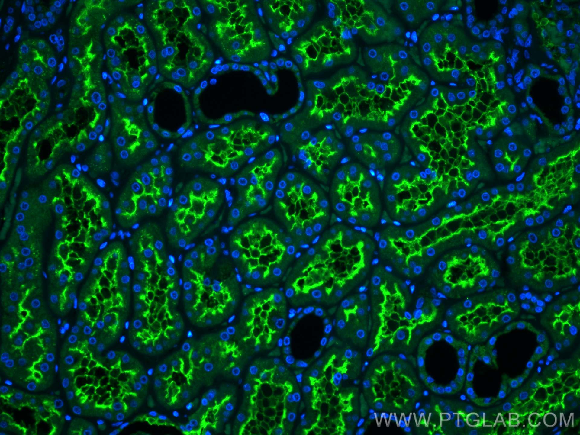 Immunofluorescence (IF) / fluorescent staining of human kidney tissue using MME,CD10 Polyclonal antibody (23782-1-AP)