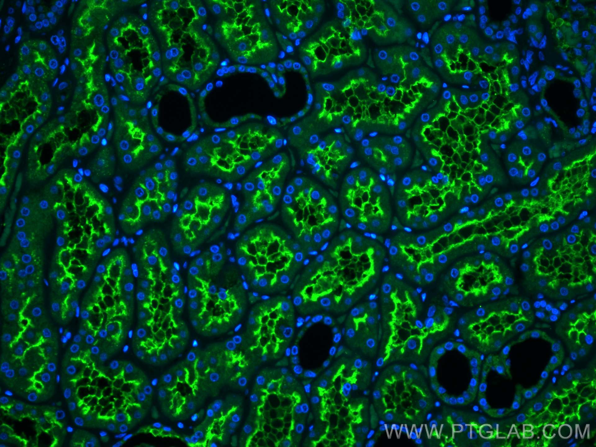 IF Staining of human kidney using 23782-1-AP