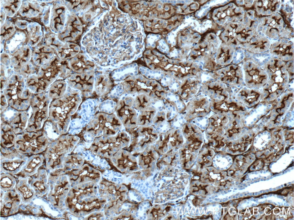 Immunohistochemistry (IHC) staining of human kidney tissue using MME,CD10 Polyclonal antibody (23782-1-AP)