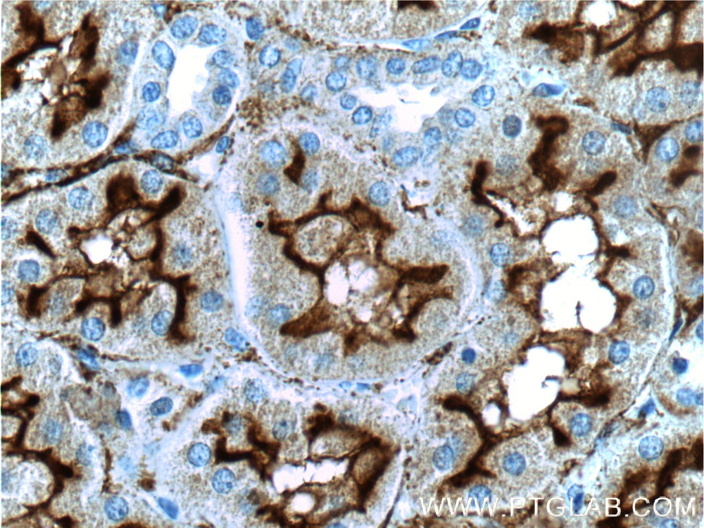 Immunohistochemistry (IHC) staining of human kidney tissue using MME,CD10 Polyclonal antibody (23782-1-AP)