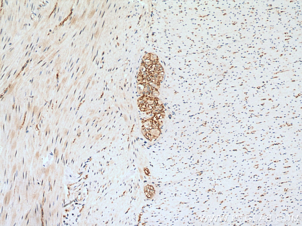 Immunohistochemistry (IHC) staining of human colon tissue using CD100 Polyclonal antibody (27516-1-AP)