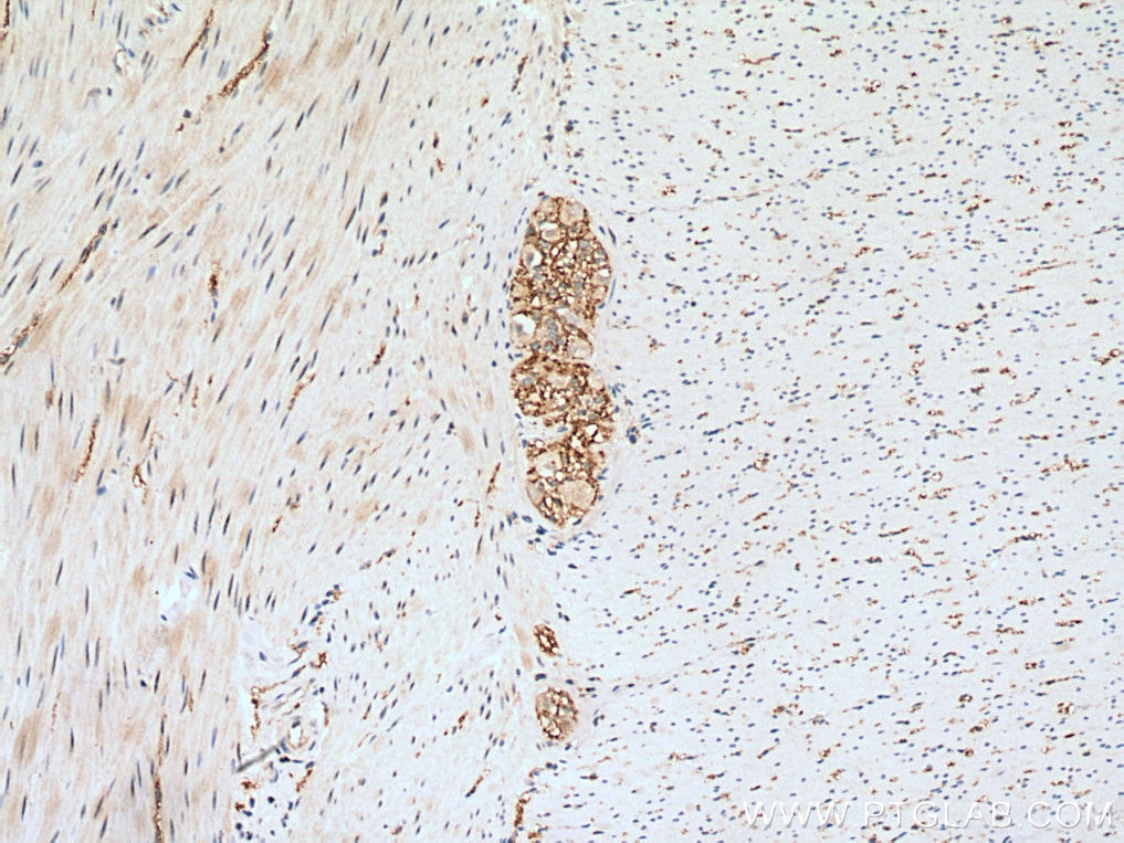 Immunohistochemistry (IHC) staining of human colon tissue using CD100 Polyclonal antibody (27516-1-AP)