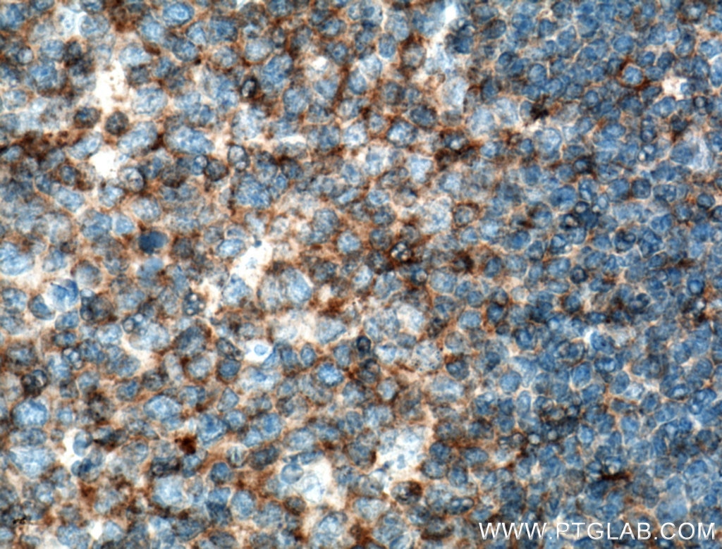 Immunohistochemistry (IHC) staining of human tonsillitis tissue using CD100 Monoclonal antibody (66582-1-Ig)