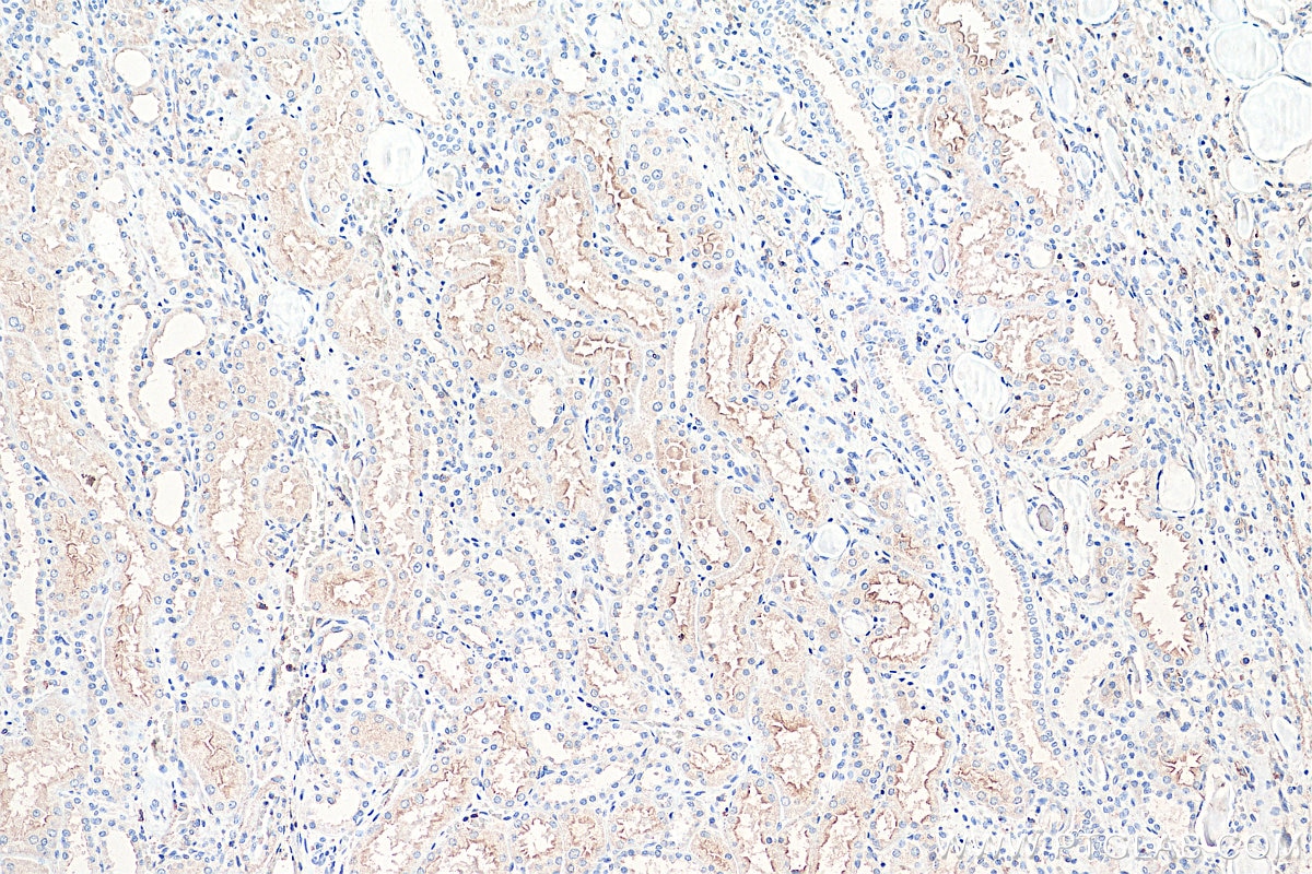 Immunohistochemistry (IHC) staining of human kidney tissue using CD100 Monoclonal antibody (66582-1-Ig)