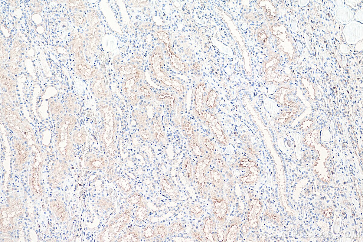 IHC staining of human kidney using 66582-1-Ig