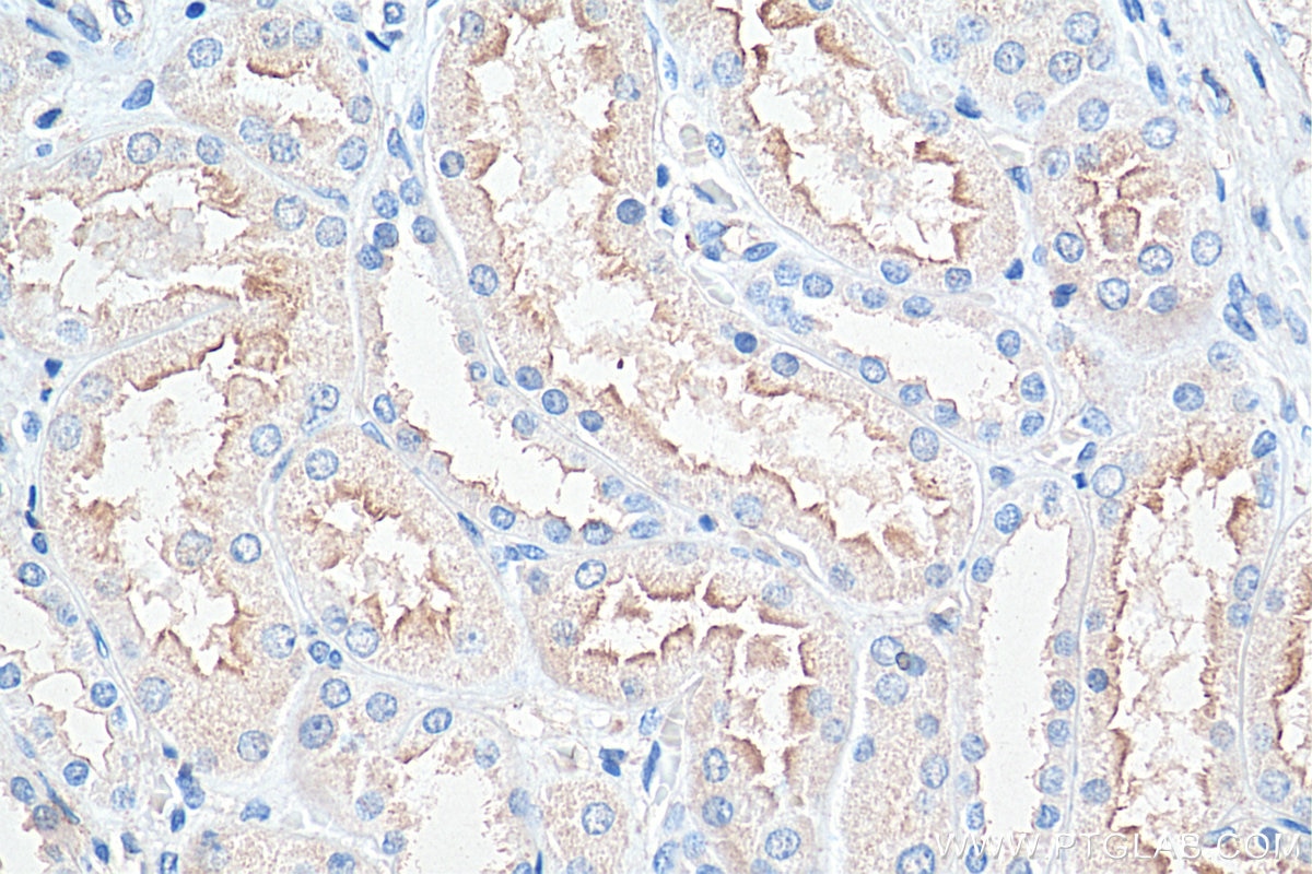 Immunohistochemistry (IHC) staining of human kidney tissue using CD100 Monoclonal antibody (66582-1-Ig)