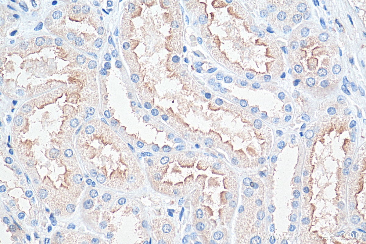 IHC staining of human kidney using 66582-1-Ig